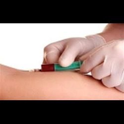 Vitamin D, 25-Hydroxy