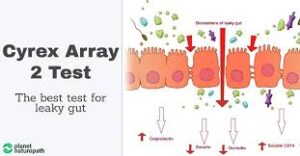Cyrex Array #2 - Leaky Gut Test: Intestinal Antigenic Permeability Screen (Includes Doctor's Consultation with All Test Results)