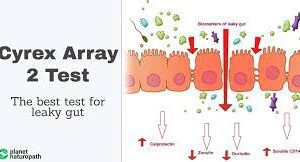 Cyrex Array #2 - Leaky Gut Test: Intestinal Antigenic Permeability Screen (Includes Doctor's Consultation with All Test Results)