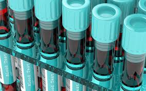 Multiplex 1 W/O Iron 240 Capsules